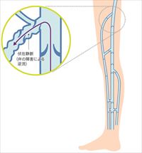 原因は