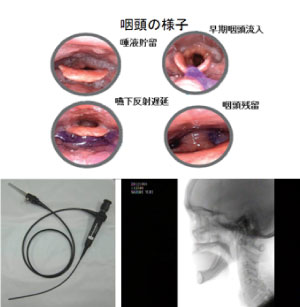 検査の様子